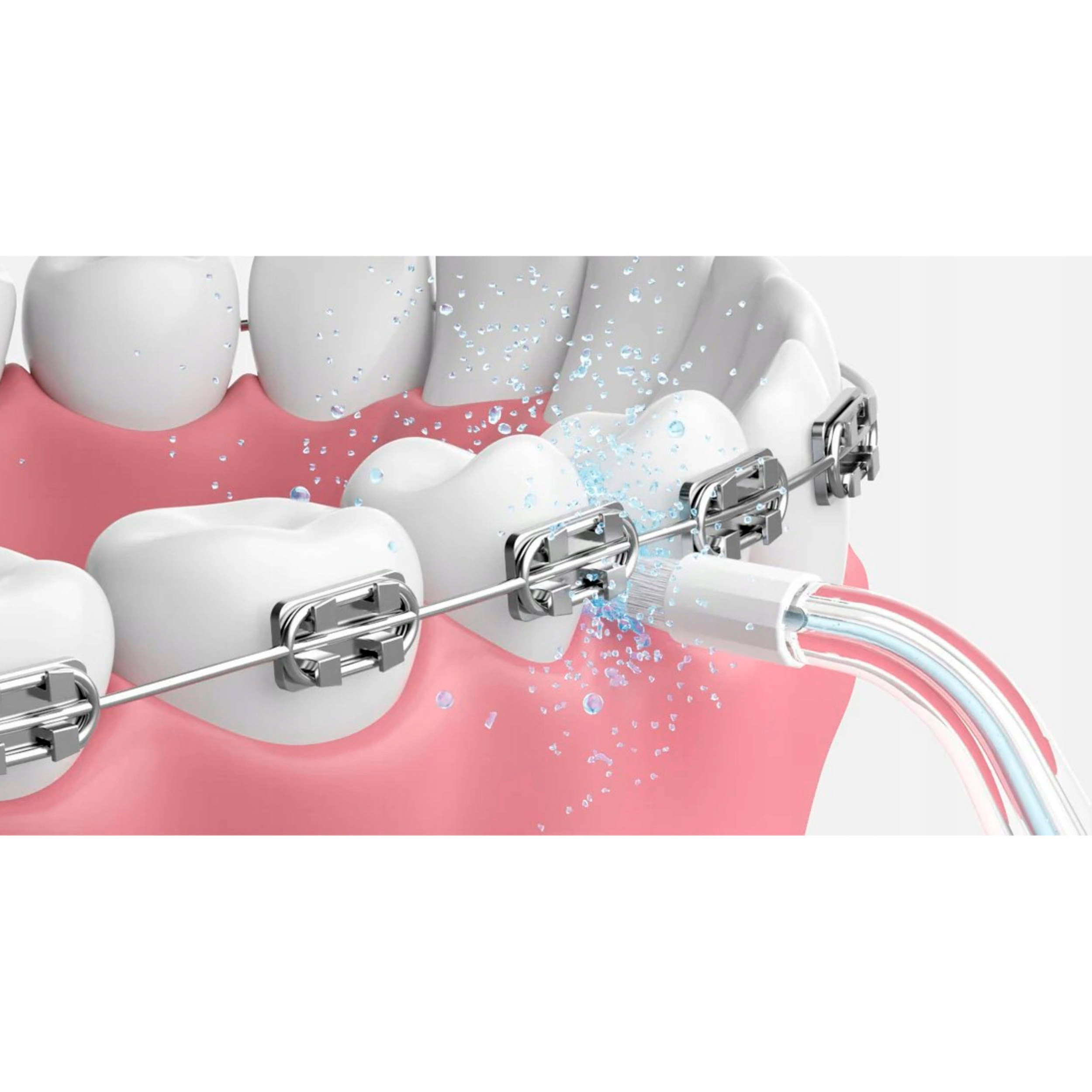 Комплект насадок для ирригатора OCLEAN AirPump A10 Water Flosser Orthodontics Nozzle Transparent 2шт (6970810556131)