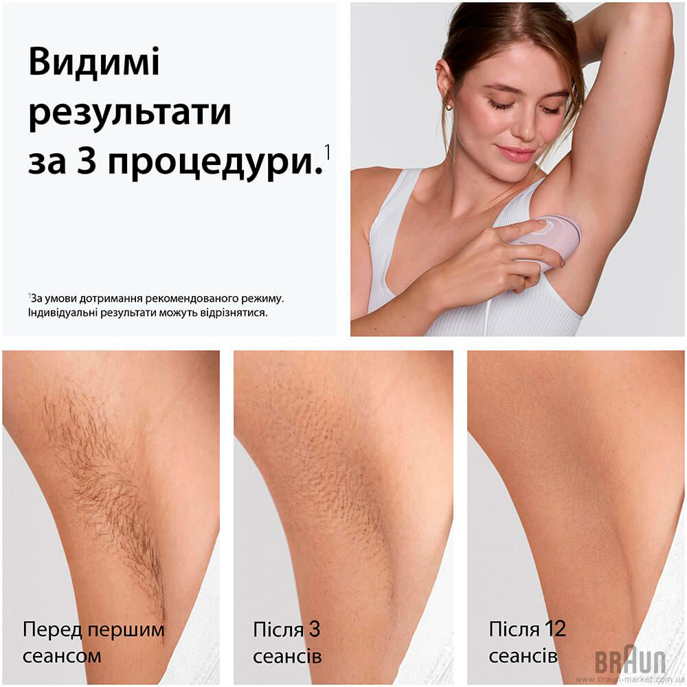 Фотоэпилятор BRAUN Silk-expert Mini PL 1111 (80851272)